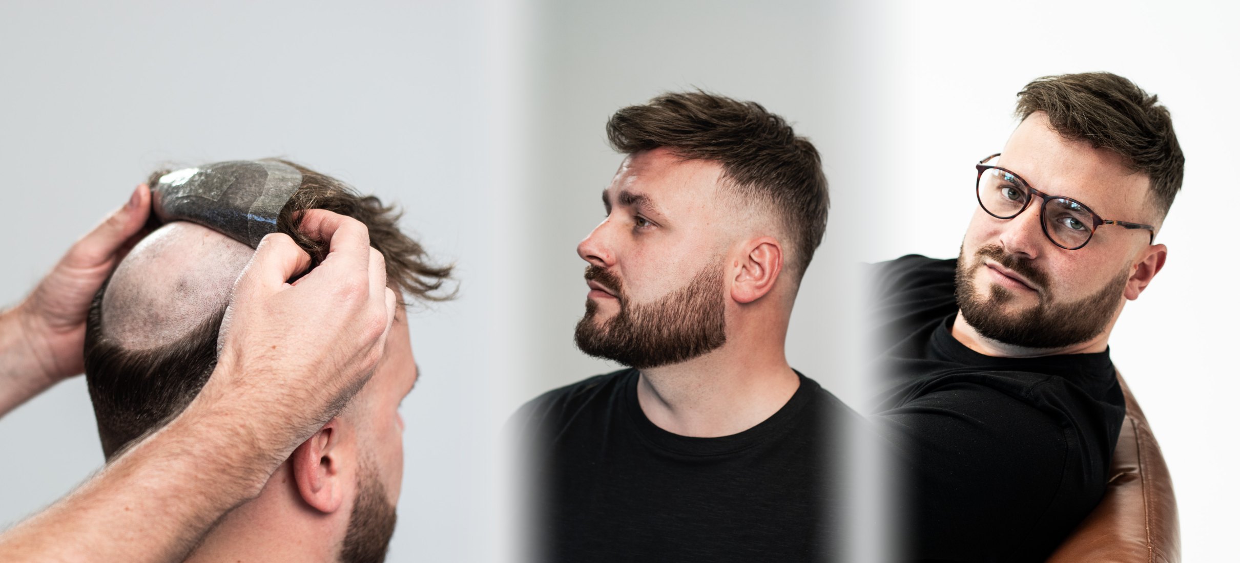 Montaż systemu włosów i efekt końcowy – salon Hairline Kraków